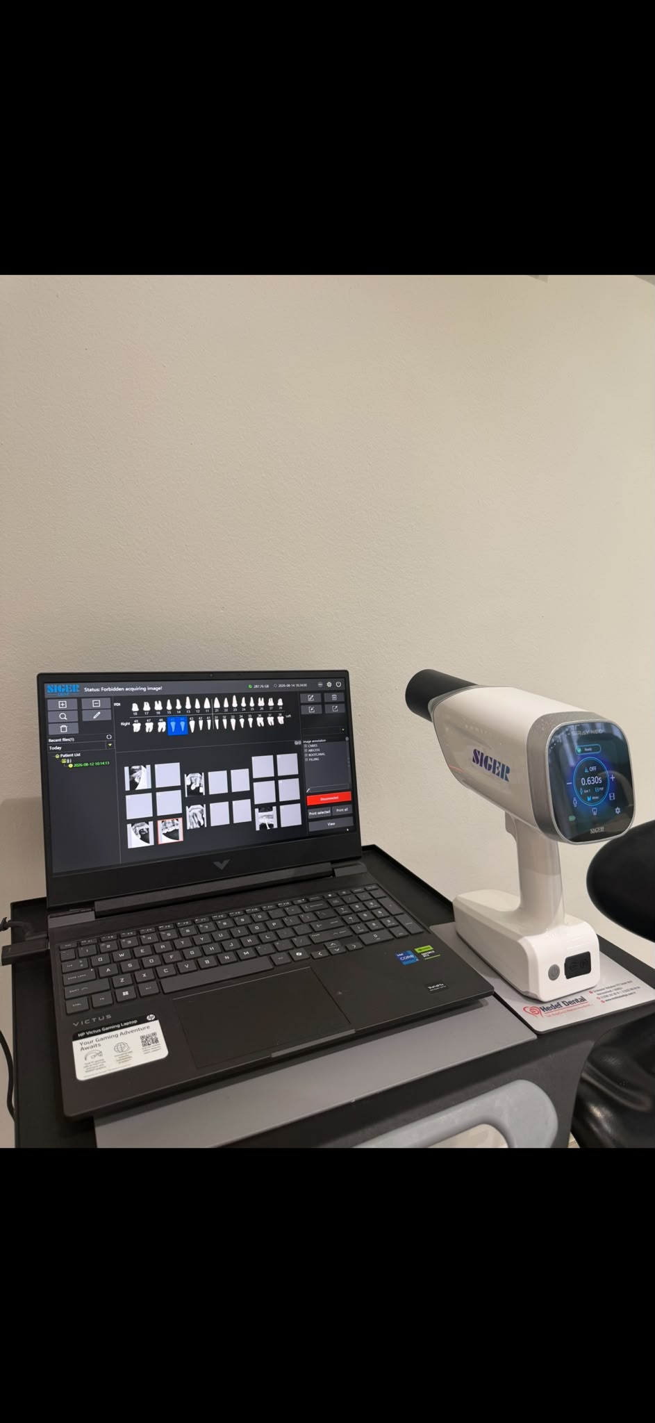 Digital X-Ray Technology - AS Dental